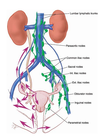 Anatomie schématique du drainage des organes pelviens - chaines pelvienne et lombo-Aortique