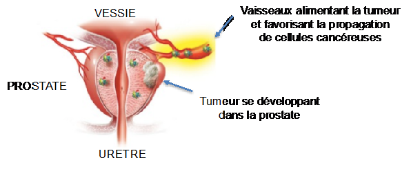 Fosfataza acidă la prostate
